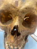 An Unusual Real Pediatric and Adult Skull Mounted Science Display