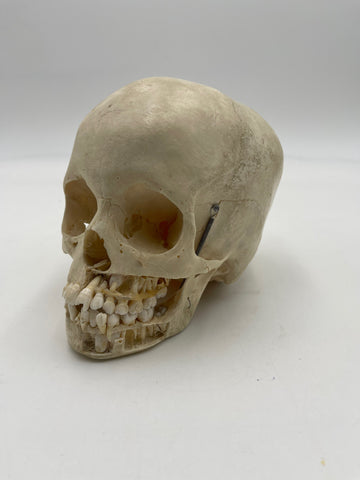 A Very Nice Real Human Pediatric Skull With Dissected Jaw 303