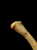A Medically Lightened Human Clavicle