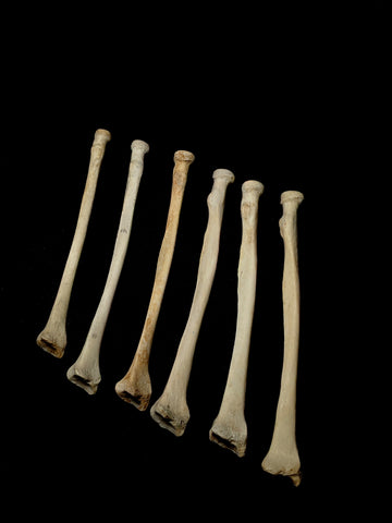 Set Of 6 Medically Lightened Human Radius Bones