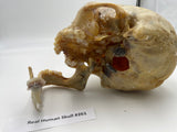 A Real Uncut Human Skull With Uncut Calvarium #261