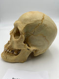 A Real Uncut Human Skull With Cracked Calvarium #263