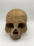 Antique Real Human Skull #301