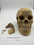 A Real Uncut Human Skull Damaged Temporal #265