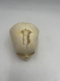 3 Month Old Pediatric / Fetal Skull