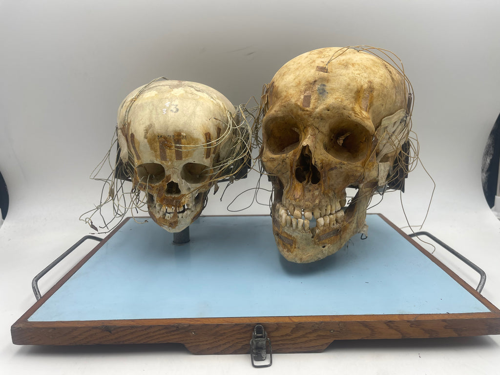 An Unusual Real Pediatric and Adult Skull Mounted Science Display