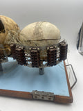 An Unusual Real Pediatric and Adult Skull Mounted Science Display