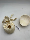 A Real Human Adolescent Skull 606