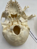 A Real Human Adolescent Skull 606