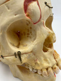 A Vintage Real Human Dissected Skull 202