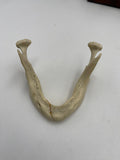 Antique Edentulous Jaw Pathology Display with Real Human Mandibles