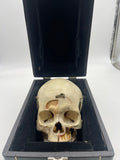 A Vintage Real Human Dissected Skull With Case 203
