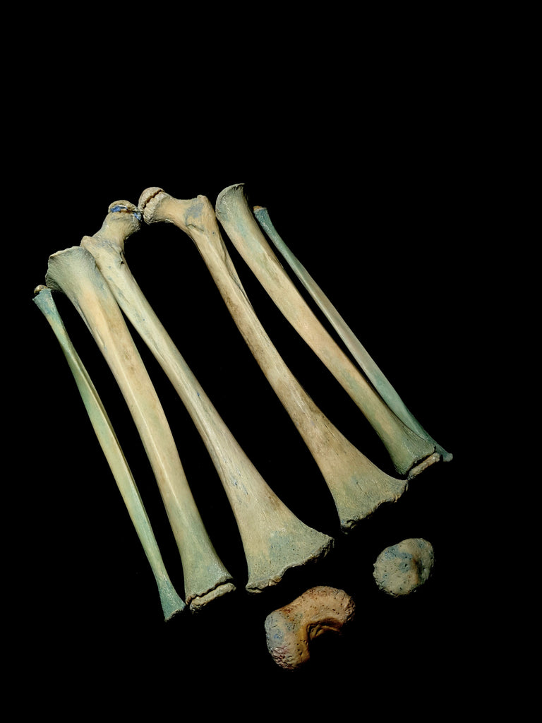 Young Pediatric Human Leg Bone Set