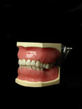 Kilgore Dental Model Of Various Tooth Erosion