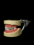 Pediatric Dental Model With Fillings And Caps