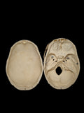 Carolina Biological Human Skull With Foramen Infection