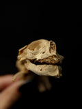 Pathology Anencephaly Fetal Human Skull